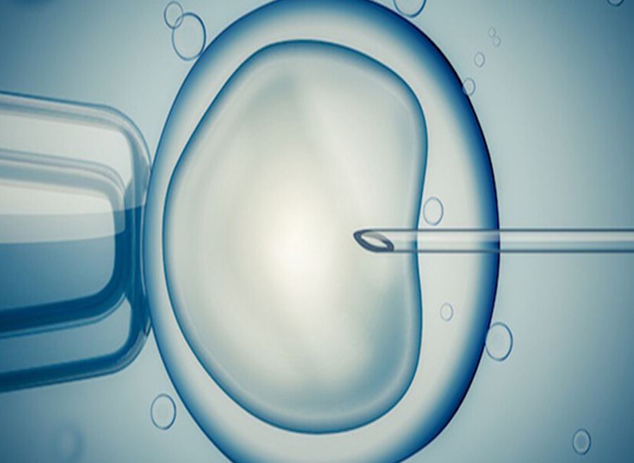 IVF PROTOCOLS